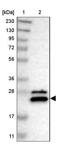 Lane 1: Marker [kDa] 230, 130, 95, 72, 56, 36, 28, 17, 11Lane 2: Human cell line RT-4