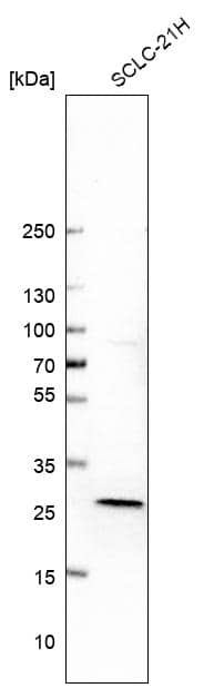 Analysis in human cell line SCLC-21H.