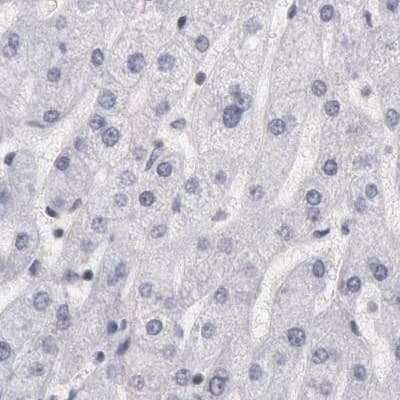Immunohistochemistry-Paraffin DGCR14 Antibody - BSA Free