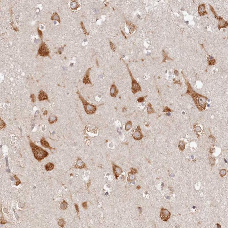 Staining of human cerebral cortex shows strong cytoplasmic positivity in neurons.