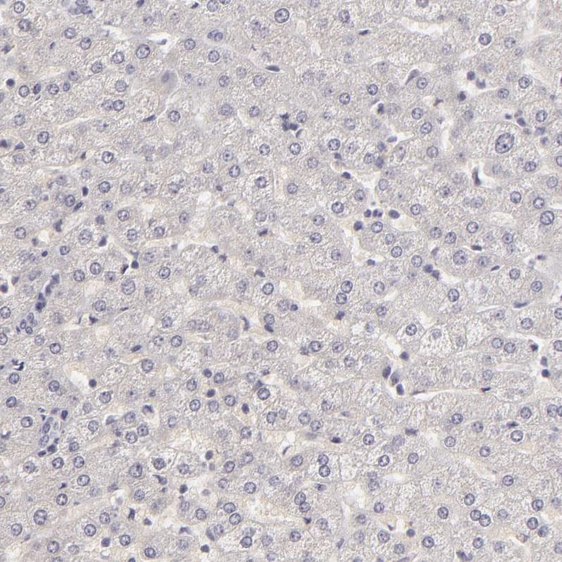 Staining of human liver shows no nuclear positivity in hepatocytes as expected.