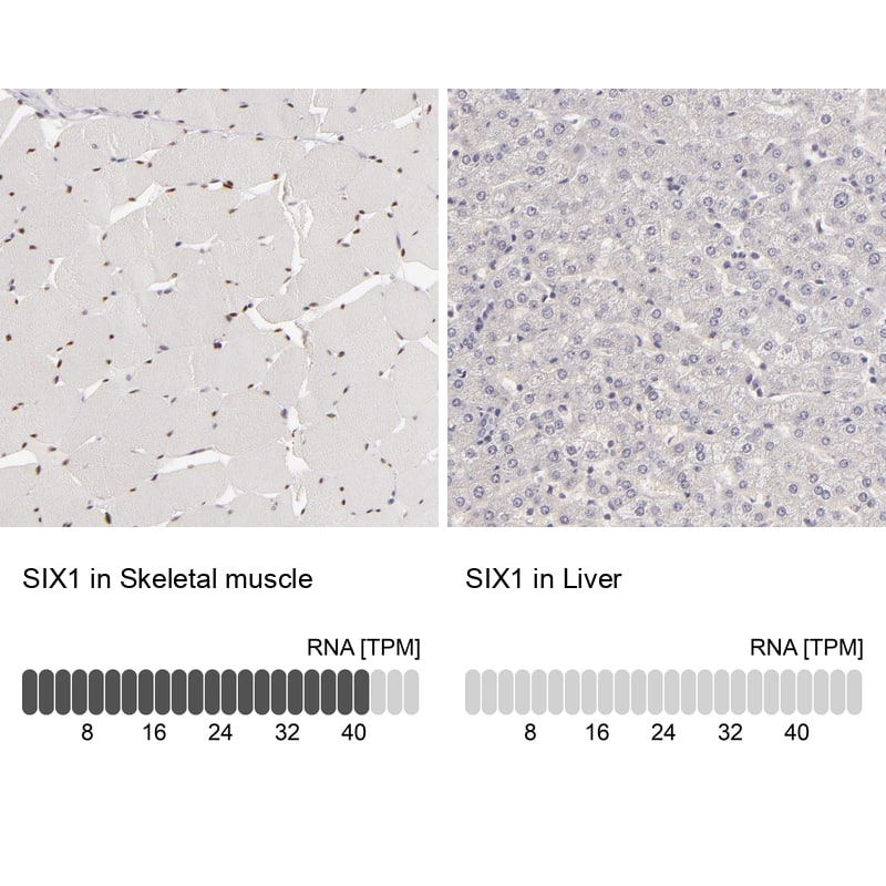 Analysis in human skeletal muscle and liver tissues using HPA001893 antibody. Corresponding SIX1 RNA-seq data are presented for the same tissues.