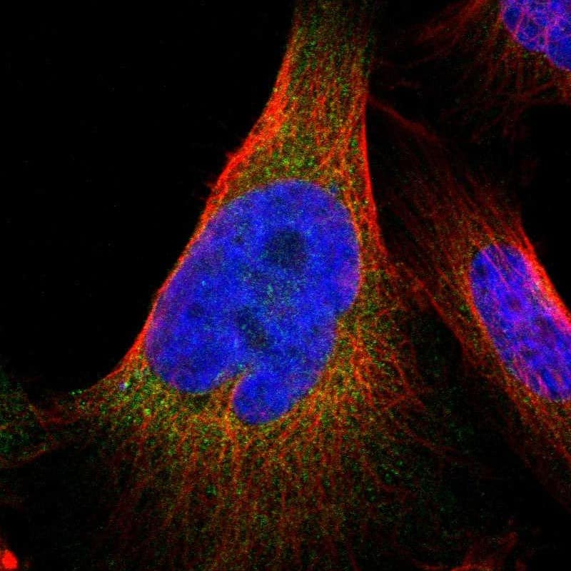 Staining of human cell line U-251 MG shows localization to endoplasmic reticulum.