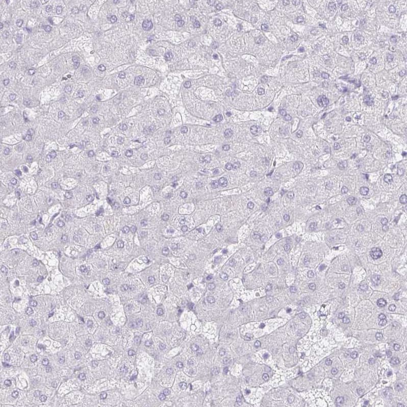 Staining of human liver shows no cytoplasmic positivity in hepatocytes as expected.