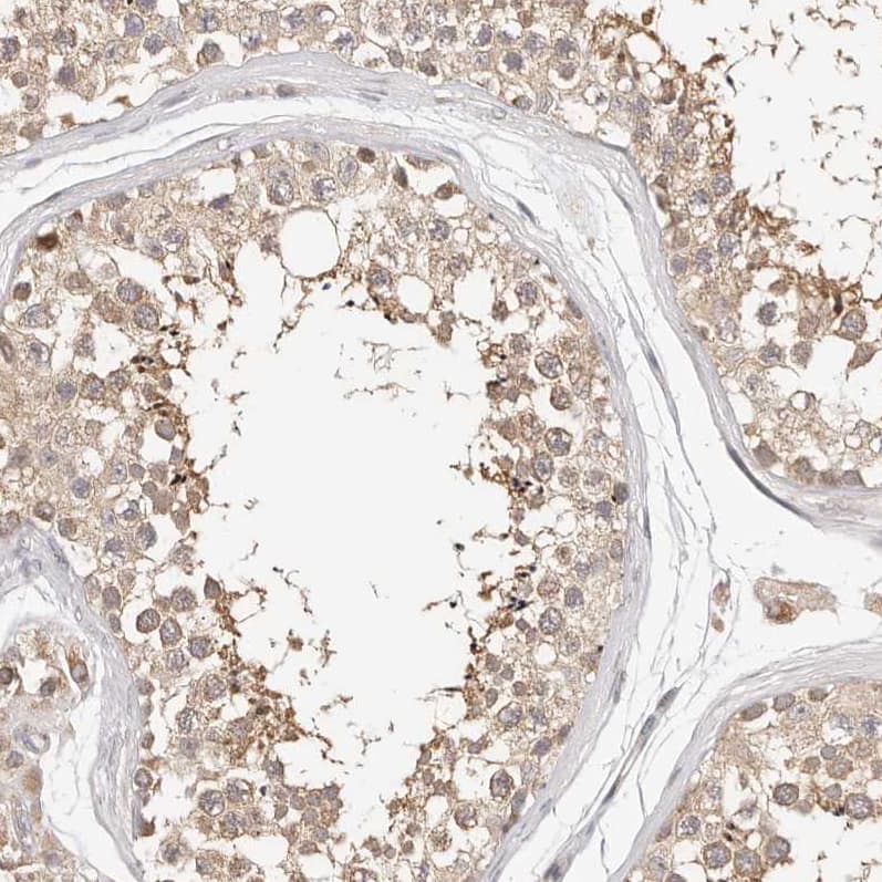 Immunohistochemistry-Paraffin KCMF1 Antibody - BSA Free