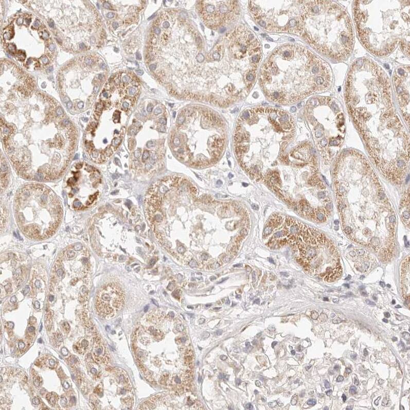 Staining of human kidney shows weak to moderate cytoplasmic positivity in cells in tubules.
