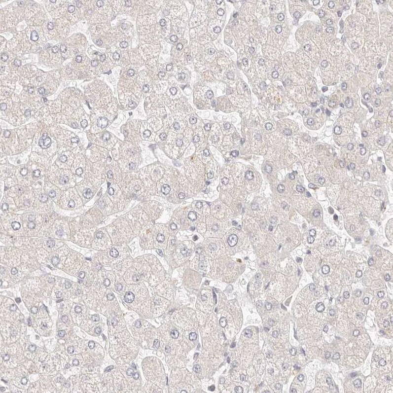 Staining of human liver shows no cytoplasmic positivity in hepatocytes as expected.