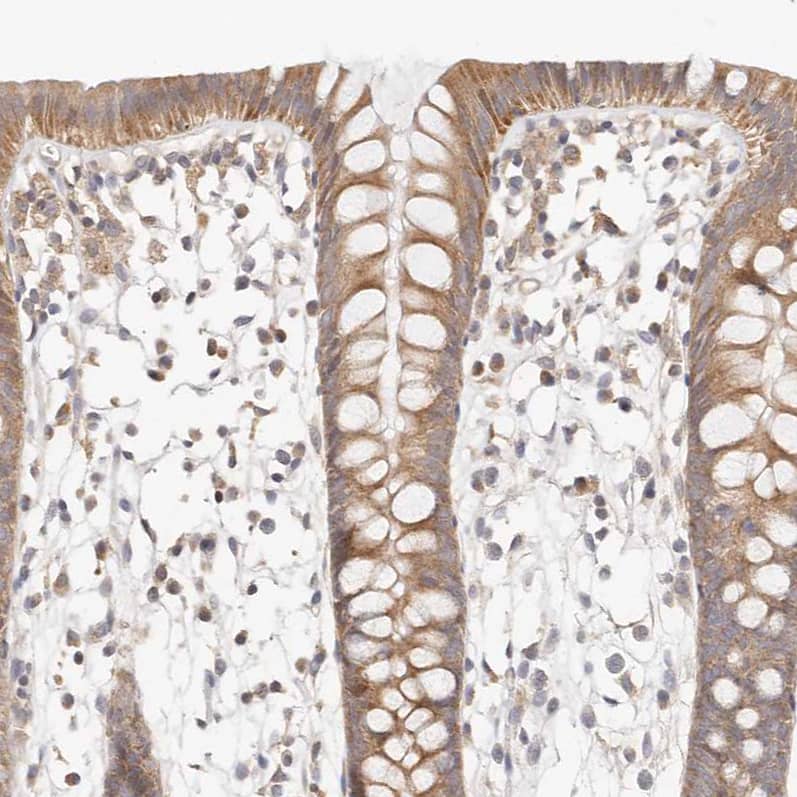 Staining of human colon shows moderate cytoplasmic positivity in glandular cells.