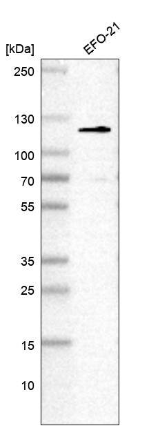 Analysis in human cell line EFO-21.