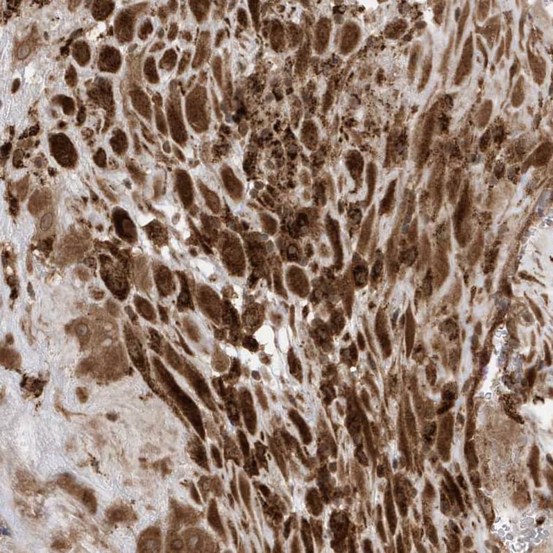 Staining of human placenta shows strong cytoplasmic positivity in decidual cells.
