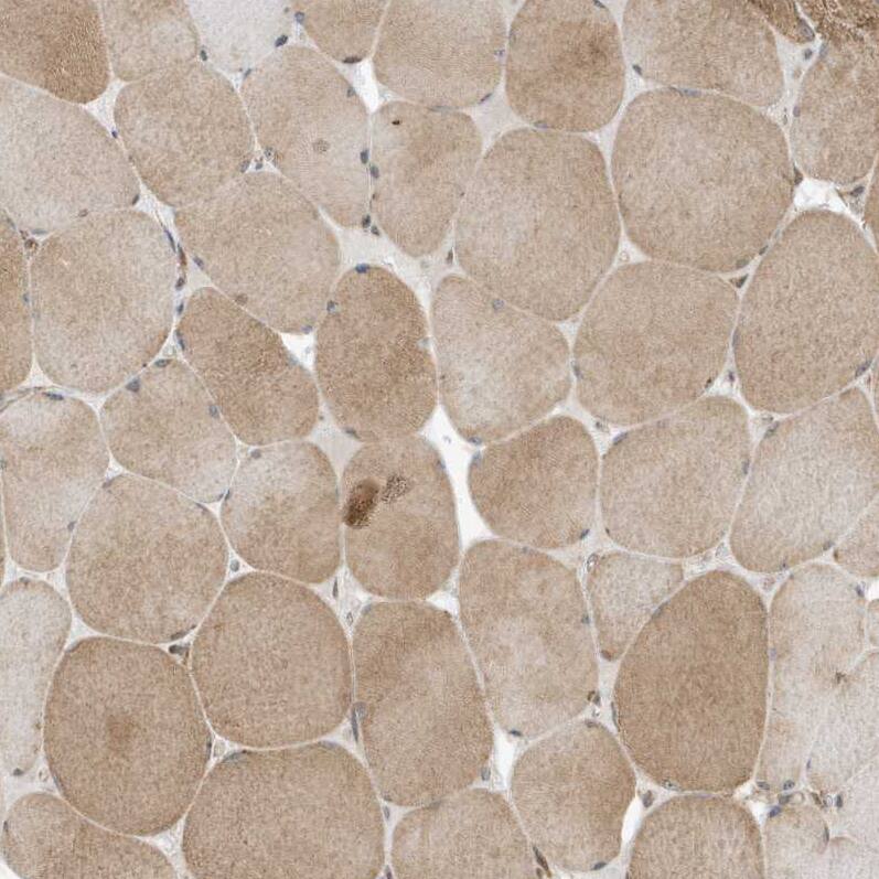 Staining of human skeletal muscle shows moderate cytoplasmic positivity in myocytes.