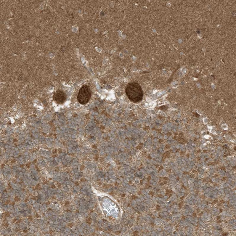 Staining of human cerebellum shows strong cytoplasmic positivity in Purkinje cells.