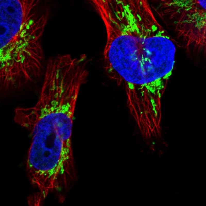 Immunocytochemistry/ Immunofluorescence DSCR3 Antibody - BSA Free