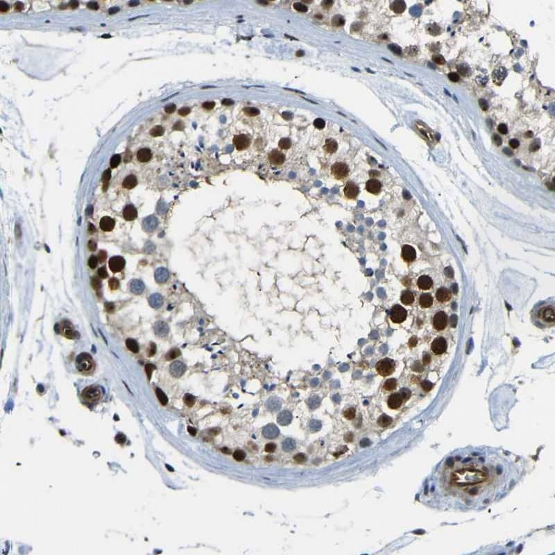 Staining of human testis shows high expression.