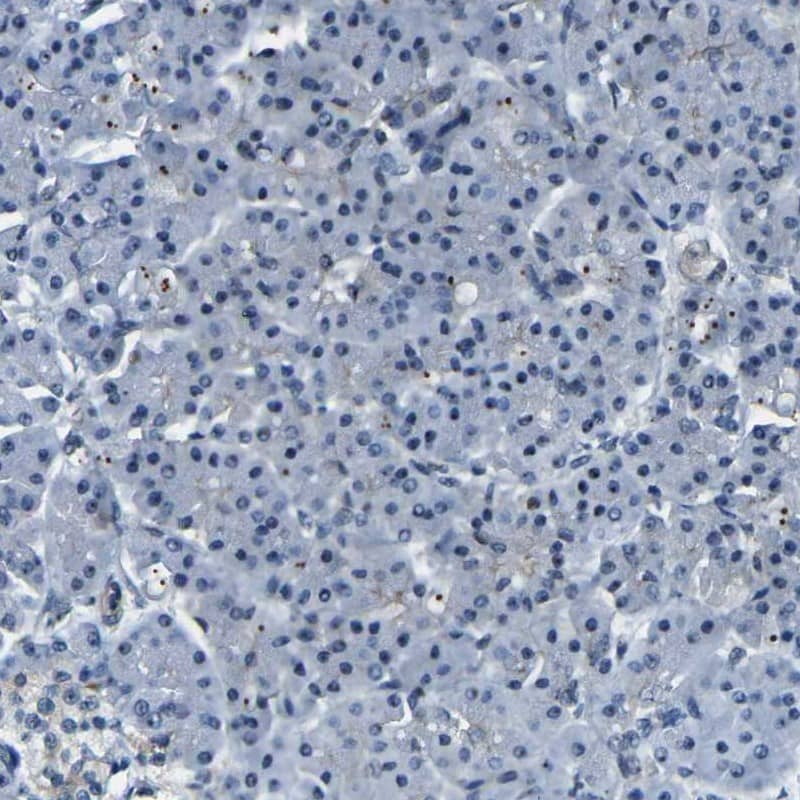 Staining of human pancreas shows low expression as expected.