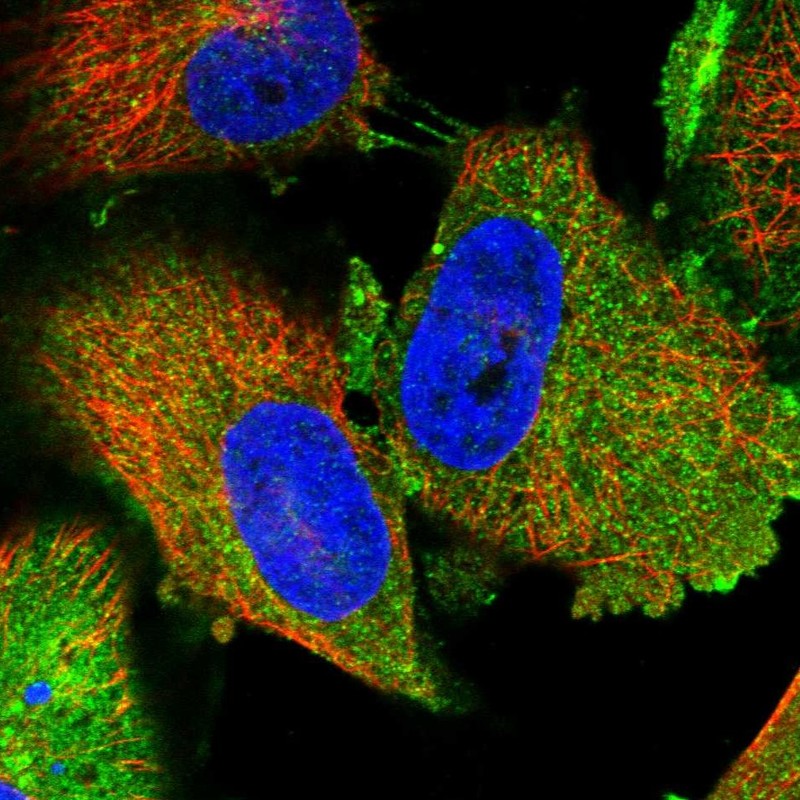 Staining of human cell line U-251 MG shows localization to plasma membrane, cytosol & cell junctions.
