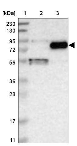 Western Blot Gamma-Glutamyltransferase 7 Antibody - BSA Free