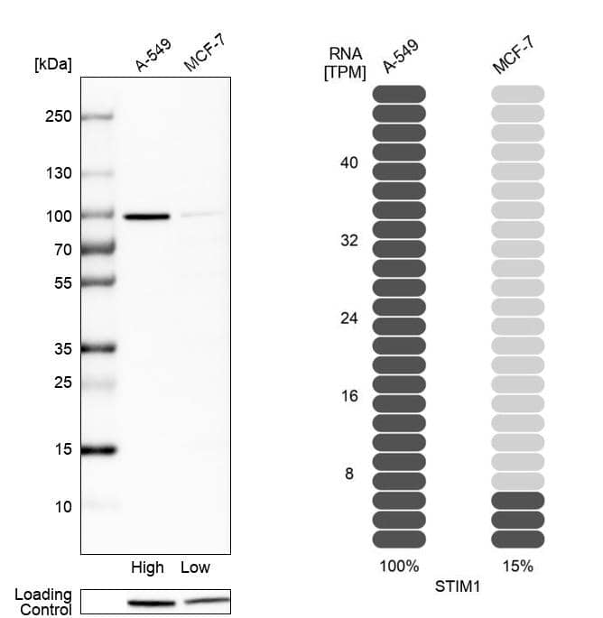 <b>Orthogonal Strategies Validation. </b>Analysis in human cell lines A-549 and MCF-7 using Anti-STIM1 antibody. Corresponding STIM1 RNA-seq data are presented for the same cell lines. Loading control: Anti-HSP90B1.