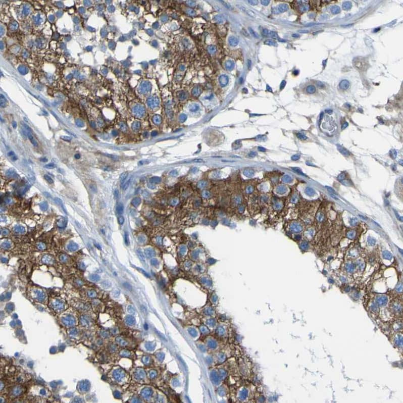 Staining of human testis shows strong cytoplasmic positivity in cells in seminiferous ducts.