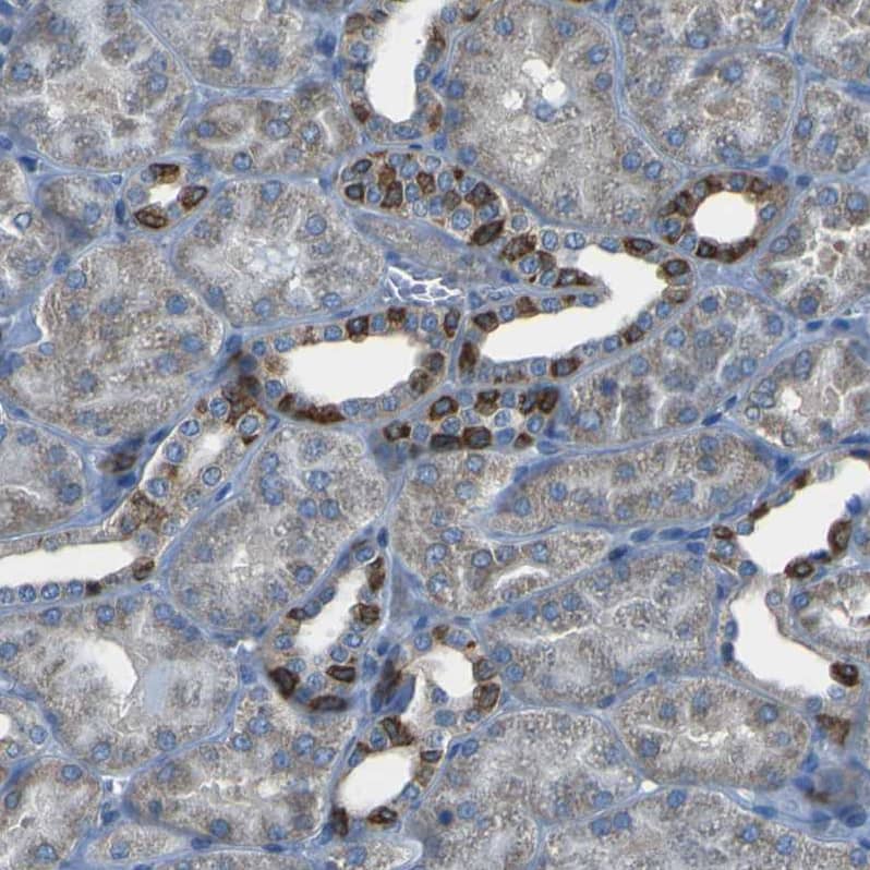 Staining of human kidney shows strong cytoplasmic positivity in cells in tubules.