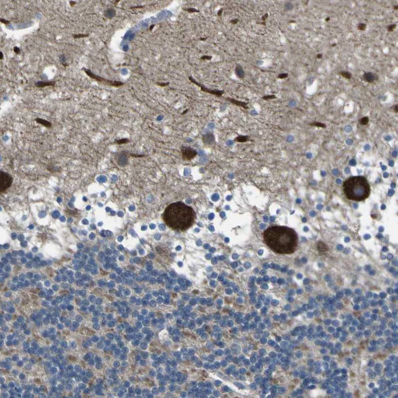 Staining of human cerebellum shows strong cytoplasmic positivity in Purkinje cells.