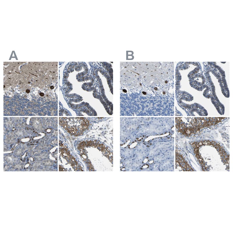 <b>Orthogonal Strategies Validation. </b>Staining of human cerebellum, fallopian tube, kidney and testis HPA011088 (A) shows similar protein distribution across tissues to independent antibody HPA012123 (B).