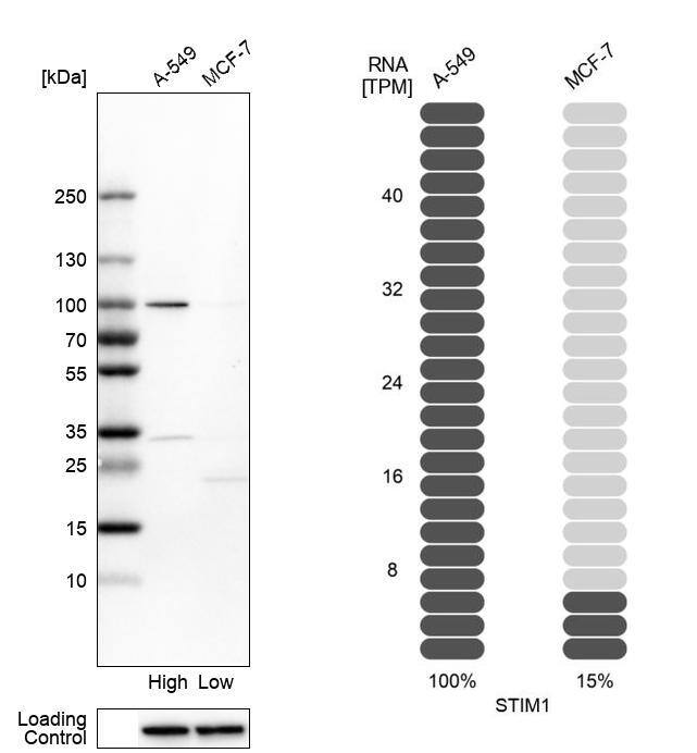 <b>Orthogonal Strategies Validation. </b>Analysis in human cell lines A-549 and MCF-7 using Anti-STIM1 antibody. Corresponding STIM1 RNA-seq data are presented for the same cell lines. Loading control: Anti-HSP90B1.