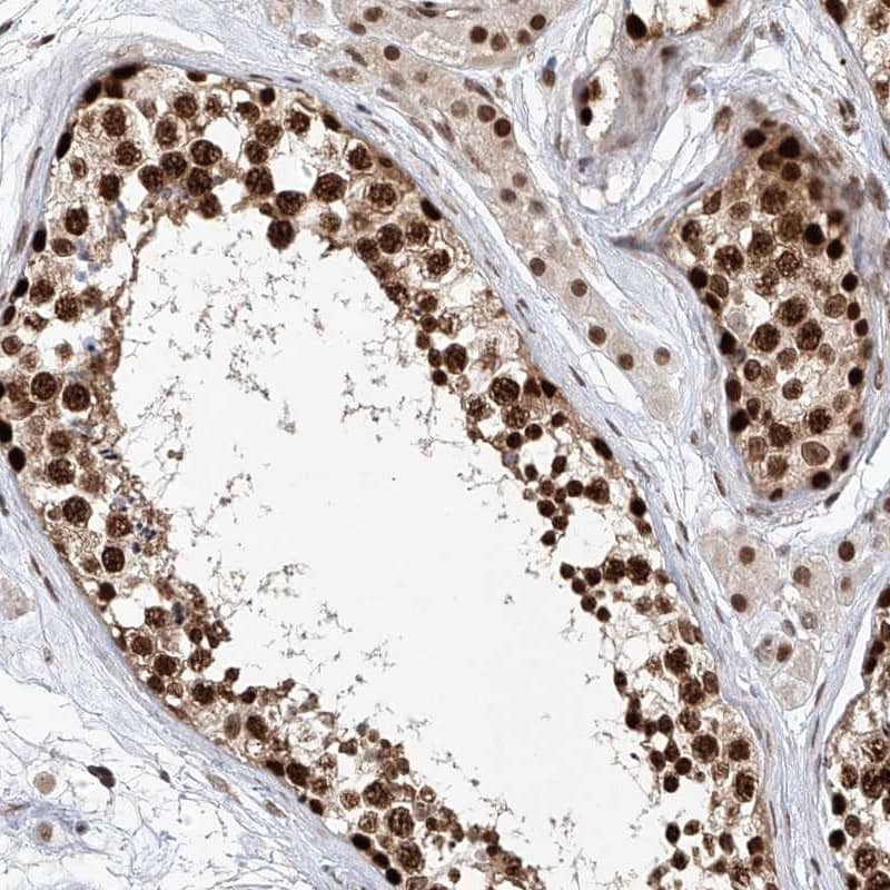 Immunohistochemistry-Paraffin Zinc finger protein 470 Antibody - BSA Free