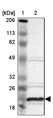 Lane 1: Marker [kDa] 206, 113, 82, 49, 32, 26, 18Lane 2: Human cell line RT-4