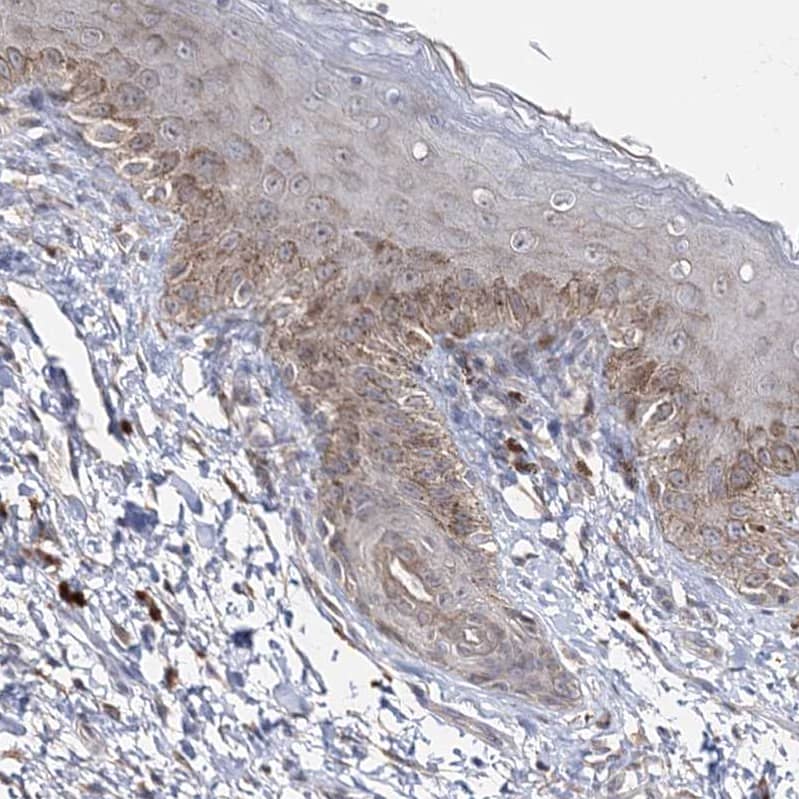 Immunohistochemistry-Paraffin Connexin 30.1/GJB5 Antibody - BSA Free