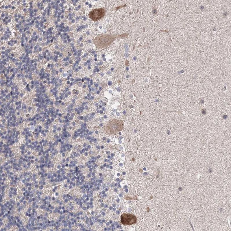 Immunohistochemistry-Paraffin Connexin 30.1/GJB5 Antibody - BSA Free