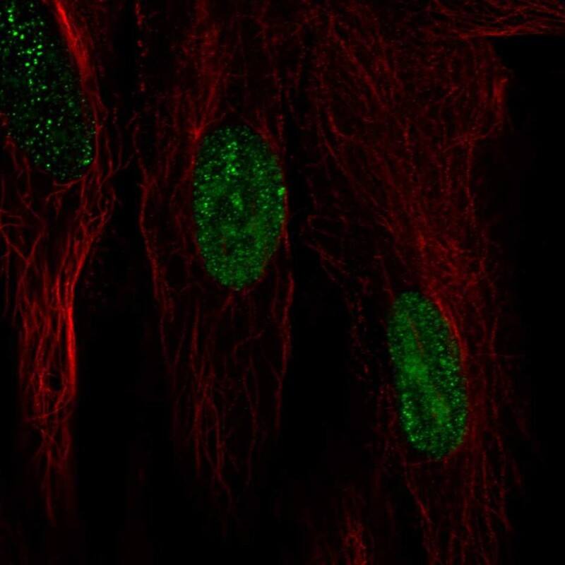 Immunocytochemistry/ Immunofluorescence HspB7 Antibody - BSA Free