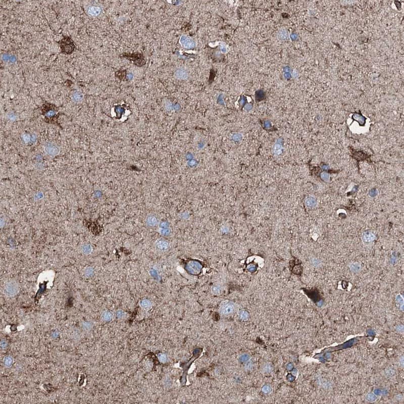 Staining of human cerebral cortex shows strong cytoplasmic positivity in glial cells.
