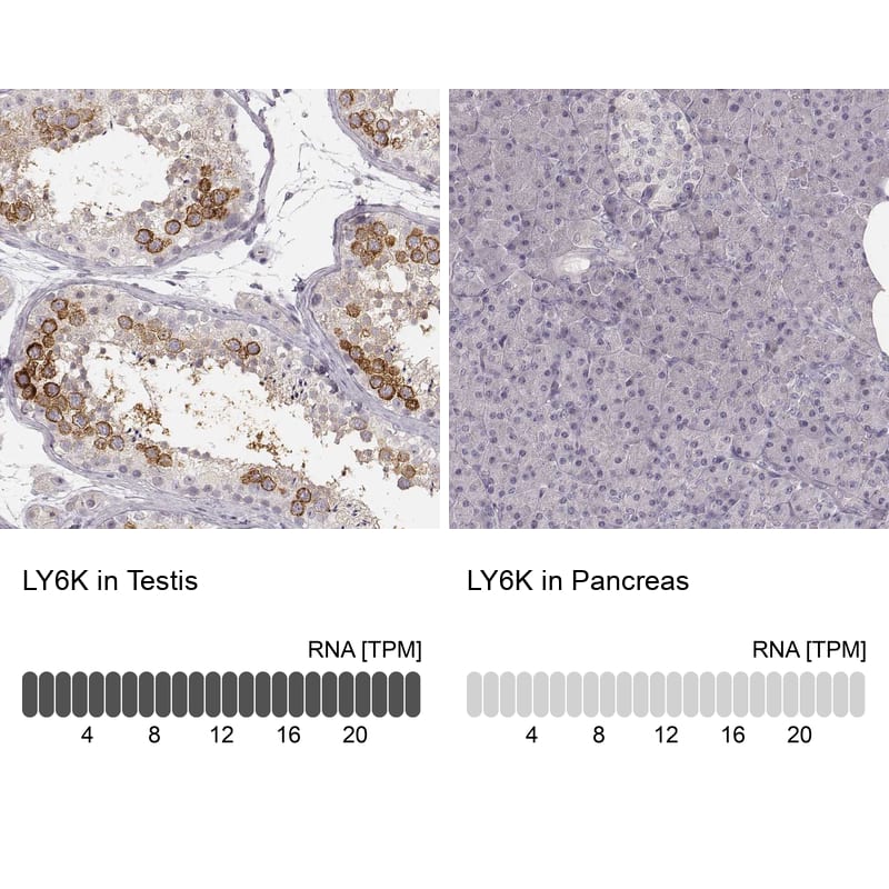 <b>Orthogonal Strategies Validation. </b>Analysis in human testis and pancreas tissues using HPA017770 antibody. Corresponding LY6K RNA-seq data are presented for the same tissues.
