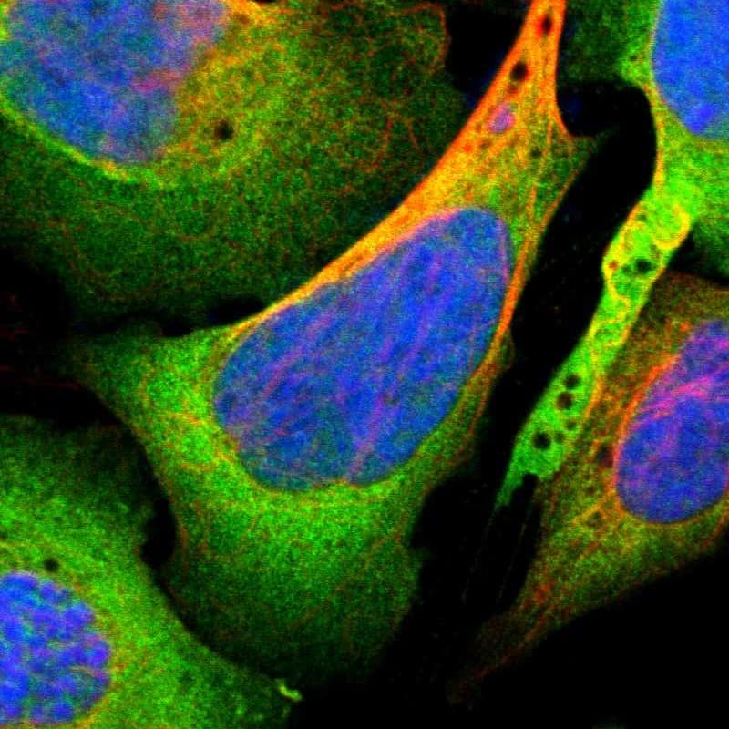 Immunocytochemistry/ Immunofluorescence PBK Antibody - BSA Free