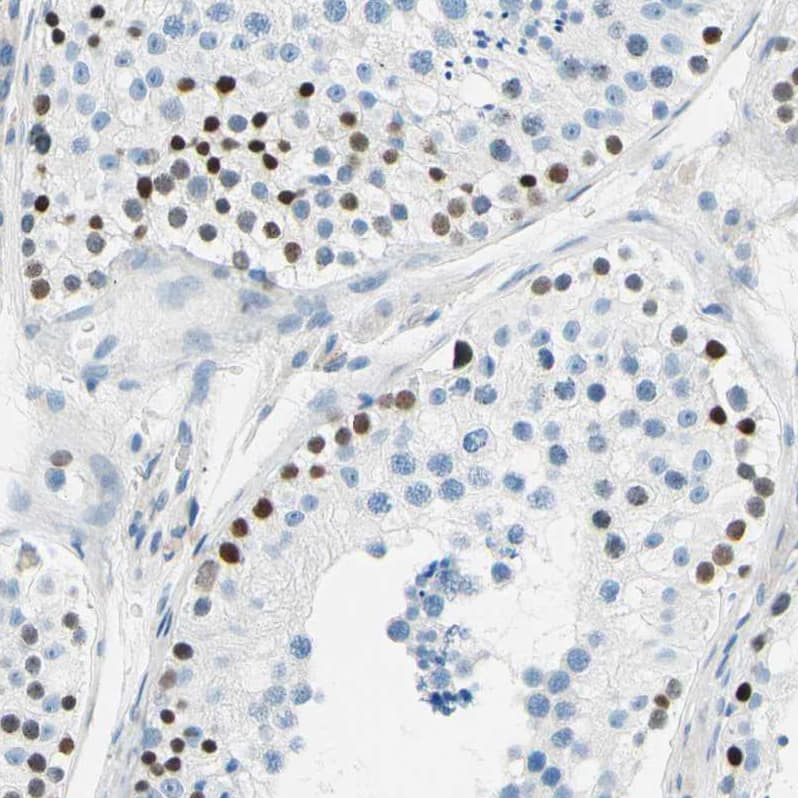 Staining of human testis shows strong nuclear positivity in cells in seminiferous ducts.