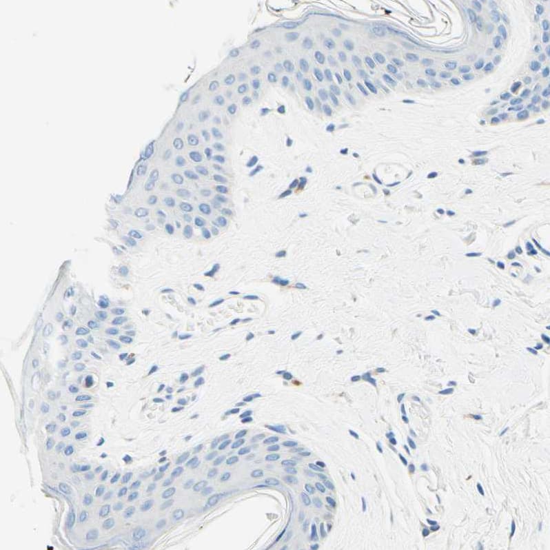 Staining of human skin shows no positivity in squamous epithelial cells as expected.
