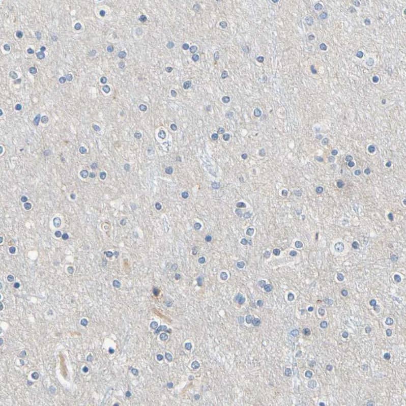 Staining of human cerebral cortex shows no positivity in neurons as expected.