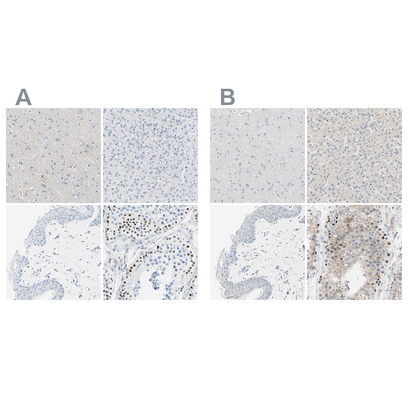 <b>Independent Antibodies Validation. </b>Staining of human cerebral cortex, liver, skin and testis using Anti-PASD1 antibody HPA011122 (A) shows similar protein distribution across tissues to independent antibody HPA011152 (B).