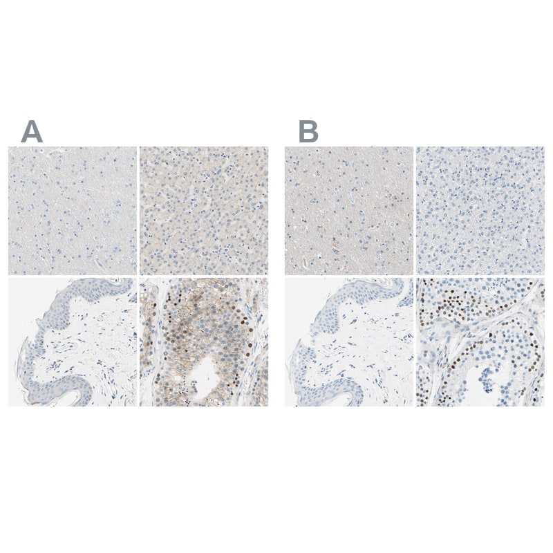 <b>Independent Antibodies Validation. </b>Staining of human cerebral cortex, liver, skin and testis using Anti-PASD1 antibody HPA011152 (A) shows similar protein distribution across tissues to independent antibody HPA011122 (B).