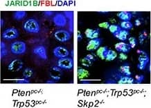 SKP2 inactivation induces an accumulation of ubiquitinated JARID1B in nucleolus of cells in vitro and in vivo for cellular senescence(A) Immunofluorescence (IF) images show a co-localization of endogenous JARID1B and Fibrillarin (FBL) in nucleoli of PC3 cells upon SKP2 knockdown (Also see Supplementary Figure S6A). FBL indicates a nucleolar marker. Right panel: quantification of PC3 cells showing an increase of JARID1B localization in nucleolus. Error bars represent means +/- SD. (B) IF images show a co-localization of endogenous JARID1B and K63-Ub in nucleoli of PC3 cells upon SKP2 knockdown. (C) Western blotting assay shows an increase of  beta -galactosidase ( beta -Gal) in PC3 cells upon SKP2 knockdown. (D) IF images show JARID1B in nucleolus as indicated by arrows and  beta -Gal in cytoplasm in senescent cells upon SKP2 knockdown. (E) The co-localization of endogenous JARID1B and Fibrillarin (FBL) in nucleoli of prostate tissues in Ptenpc−/−;Trp53pc−/−;Skp2−/− mutant mice (Also see Supplementary Figure S6B). Scale bars represent 10 μm for panel A, B, D and E. (F) The positive staining of  beta -galactosidase in prostate tissues of Ptenpc−/−;Trp53pc−/−;Skp2−/− mice but not in that of Ptenpc−/−;Trp53pc−/− mice. Scale bars represent 50 μm. Image collected and cropped by CiteAb from the following open publication (//pubmed.ncbi.nlm.nih.gov/25596733), licensed under a CC-BY license. Not internally tested by Novus Biologicals.