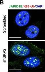 SKP2 inactivation induces an accumulation of ubiquitinated JARID1B in nucleolus of cells in vitro and in vivo for cellular senescence(A) Immunofluorescence (IF) images show a co-localization of endogenous JARID1B and Fibrillarin (FBL) in nucleoli of PC3 cells upon SKP2 knockdown (Also see Supplementary Figure S6A). FBL indicates a nucleolar marker. Right panel: quantification of PC3 cells showing an increase of JARID1B localization in nucleolus. Error bars represent means +/- SD. (B) IF images show a co-localization of endogenous JARID1B and K63-Ub in nucleoli of PC3 cells upon SKP2 knockdown. (C) Western blotting assay shows an increase of  beta -galactosidase ( beta -Gal) in PC3 cells upon SKP2 knockdown. (D) IF images show JARID1B in nucleolus as indicated by arrows and  beta -Gal in cytoplasm in senescent cells upon SKP2 knockdown. (E) The co-localization of endogenous JARID1B and Fibrillarin (FBL) in nucleoli of prostate tissues in Ptenpc−/−;Trp53pc−/−;Skp2−/− mutant mice (Also see Supplementary Figure S6B). Scale bars represent 10 μm for panel A, B, D and E. (F) The positive staining of  beta -galactosidase in prostate tissues of Ptenpc−/−;Trp53pc−/−;Skp2−/− mice but not in that of Ptenpc−/−;Trp53pc−/− mice. Scale bars represent 50 μm. Image collected and cropped by CiteAb from the following open publication (//pubmed.ncbi.nlm.nih.gov/25596733), licensed under a CC-BY license. Not internally tested by Novus Biologicals.