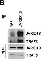 SKP2 regulates the ubiquitination of JARID1B through TRAF6(A) Immunofluorescence images show a co-localization of endogenous JARID1B and TRAF6 in PC3 cells. Scale bars represent 10 μm. (B) and (C) Co-immunoprecipitation analysis shows that endogenous TRAF6 physically interacts with JARID1B in PC3 cells, as shown by reciprocal co-immunoprecipitation between the two proteins (Also see Supplementary Figure S5). (D)In vivo ubiquitination assay shows that TRAF6 increases K63-linked ubiquitination of JARID1B and SKP2 inhibits TRAF6-mediated JARID1B ubiquitination. Cells were transfected with Flag-JARID1B, HA-Ub-K63-only, Myc-TRAF6 and Myc-SKP2 constructs as indicated. WCL indicates the whole cell lysates. (E) TRAF6 mediates JARID1B ubiquitination through lysine residue 242. HEK293T cells were transfected with Flag-JARID1B WT or Flag-JARID1B-K242R, HA-Ub-K63-only, Myc-TRAF6 and Myc-SKP2 plasmids as indicated. In vivo ubiquitination assay was performed in a standard procedure. WCL indicates the whole cell lysates. Image collected and cropped by CiteAb from the following open publication (//pubmed.ncbi.nlm.nih.gov/25596733), licensed under a CC-BY license. Not internally tested by Novus Biologicals.