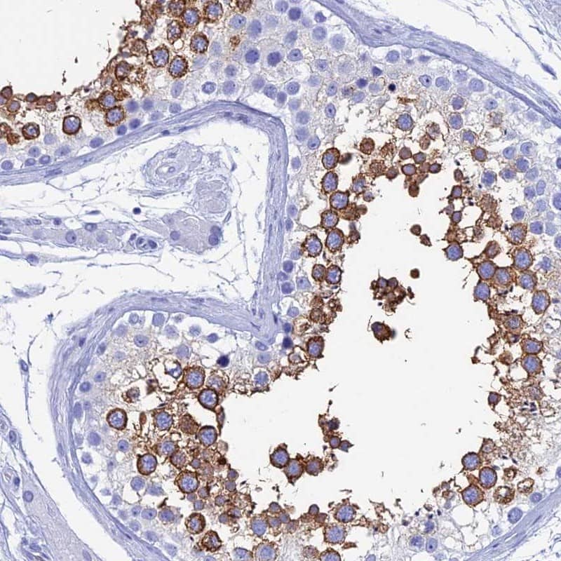 Staining of human testis shows high expression.