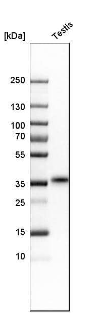 Analysis in human testis tissue.