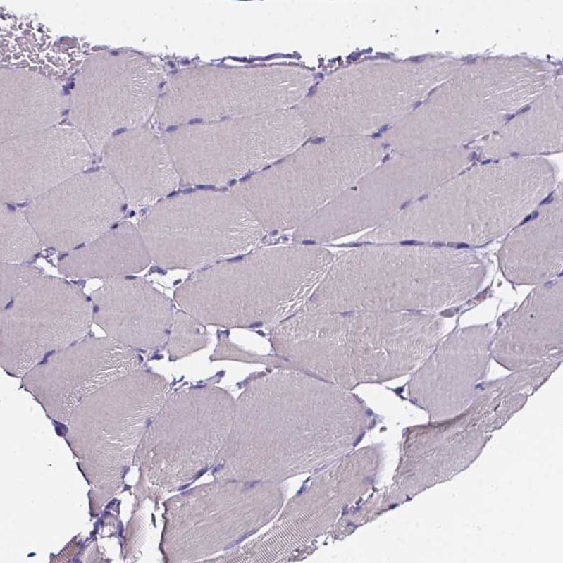 Staining of human skeletal muscle shows no positivity in myocytes as expected.