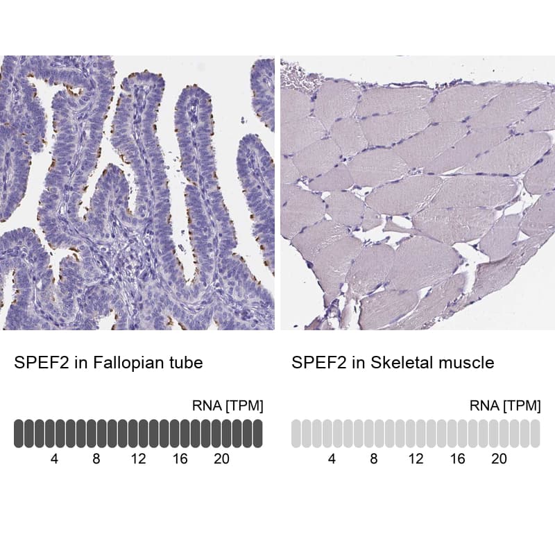 <b>Orthogonal Strategies Validation. </b>Analysis in human fallopian tube and skeletal muscle tissues. Corresponding RNA-seq data are presented for the same tissues.
