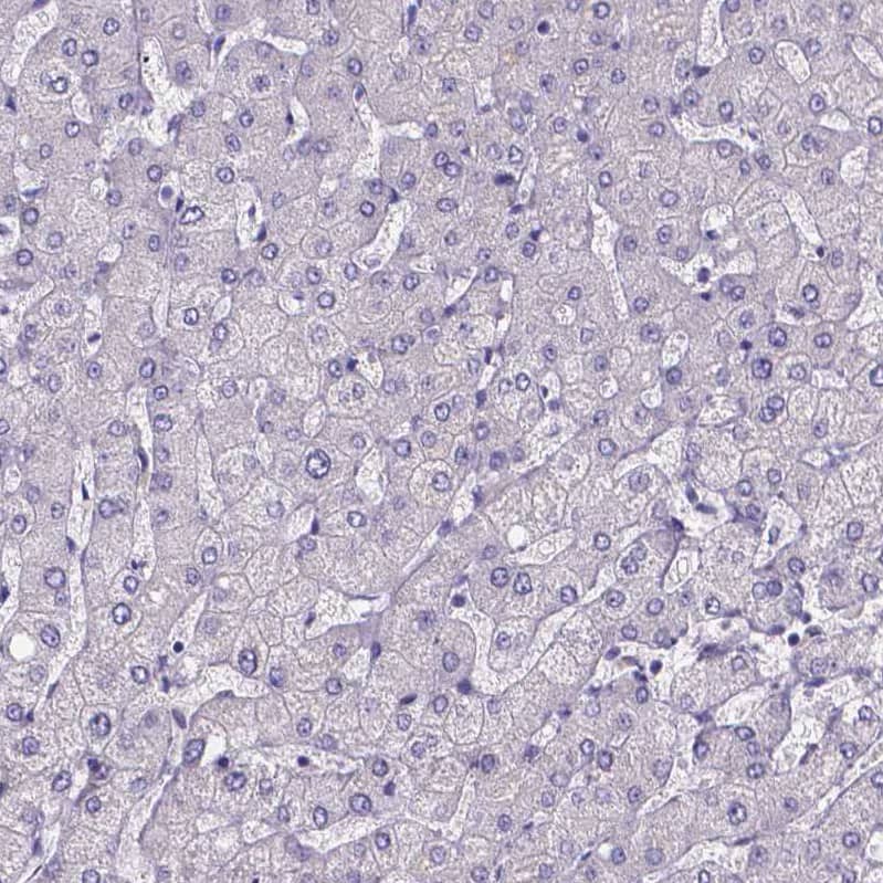 Staining of human liver shows no positivity in hepatocytes as expected.