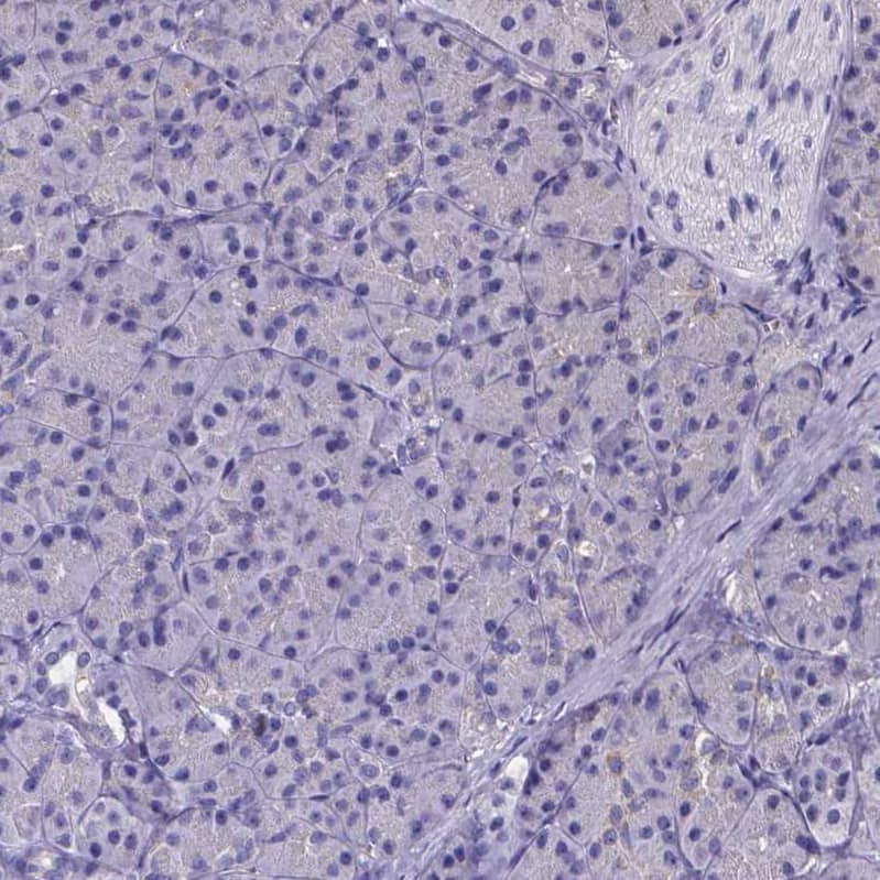 Staining of human pancreas shows no positivity in exocrine glandular cells as expected.