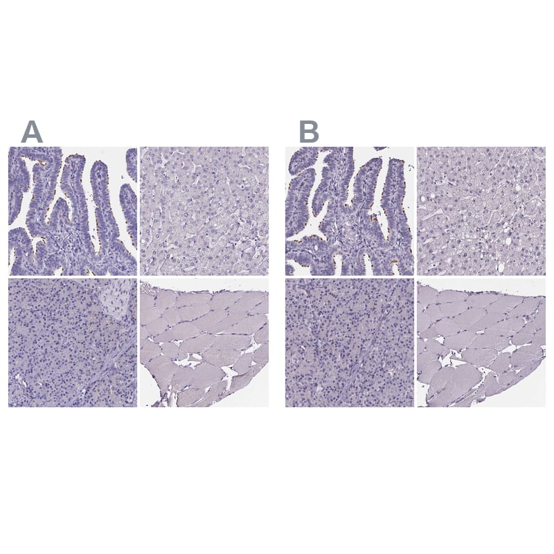 <b>Orthogonal Strategies Validation. </b>Staining of human fallopian tube, liver, pancreas and skeletal muscle HPA039606 (A) shows similar protein distribution across tissues to independent antibody HPA040343 (B).